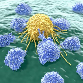 Natural killer cells are a type of lymphocytes which destroy cancer cells and other altered cells releasing cytotoxic granules.